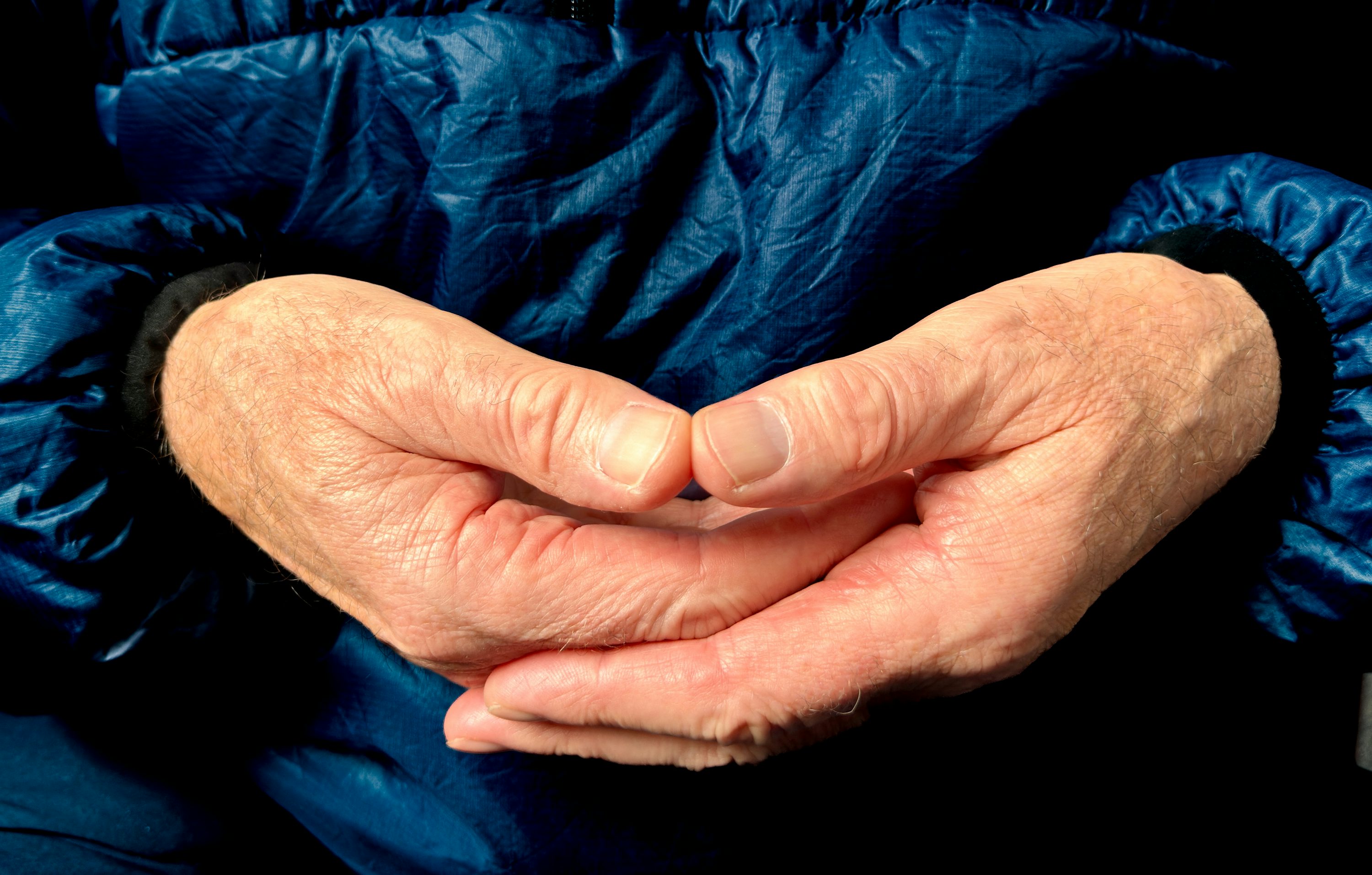 精神疾患と障害年金の受給可能性